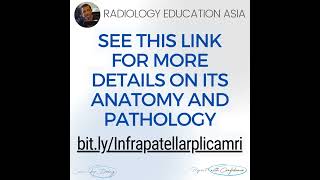 WHATS THIS STRUCTURE KNEE INFRAPATELLAR PLICA SYNDROME RADIOLOGY MRI [upl. by Eah]