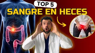 5 Causas de Sangre en las heces que NO conocías [upl. by Buskirk]