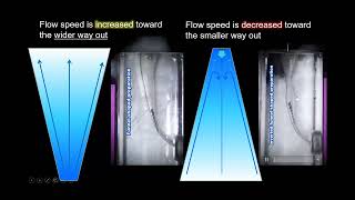 Funnel shaped preparation for broken file removal Dr yoshi terauchi [upl. by Wind]