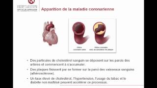 Coronaropathies  Renseignements pour les patients et les familles [upl. by Atreb337]