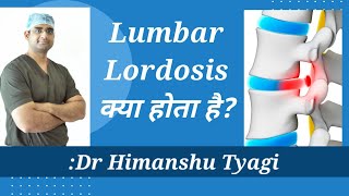 Lumbar Lordosis क्या होता है [upl. by Ttegdirb]