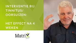 Oorsuizentinnitus verminderen het effect na 4 weken [upl. by Etem]