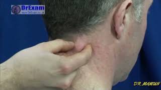 SWELLING EXAMINATIONDRMAMUN  DR EXAM [upl. by Chaker548]