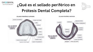 ¿Qué es el SELLADO PERIFÉRICO en PRÓTESIS DENTAL COMPLETA  LA GUÍA PASO A PASO [upl. by Schober]