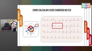 Eletrocardiograma na pericardite aguda pediátrica [upl. by Filiano]