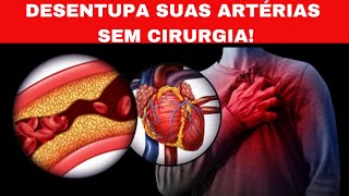 Desentupa Suas Artérias SEM CIRURGIA [upl. by Hootman248]