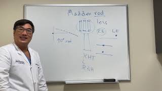 Maddox Rod Testing [upl. by Mckale160]