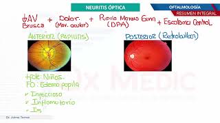 Oftalmología  Neuritis optica [upl. by Yggep837]