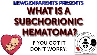 What’s a subchorionic hematoma [upl. by Aruasor]