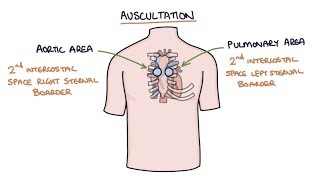 Heart Murmurs and Heart Sounds Visual Explanation for Students [upl. by Nerradal]