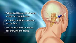 Understanding Trigeminal Neuralgia  eBrainMDcom [upl. by Mailliwnhoj]