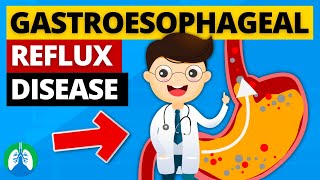 Gastroesophageal Reflux Disease GERD Explained [upl. by Nove984]