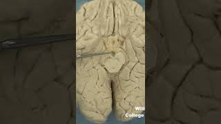 Posterior perforated substanceanatomy biology brainstemneuroanatomymidbrain [upl. by Ayomat]