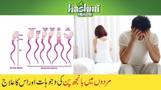 Mardana Banjhpan ka ilaj in Urdu  Hashmi Health [upl. by Auqcinahs]