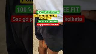 Knock Knee Medical point solution knockknock medicalpointknockknee sscgd medicaltest viralvideo [upl. by Alleyne533]