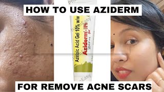 aziderm gel review honest reviewhow to use azelaic acid for acne amp acne marksacnetreatment viral [upl. by Ahseinaj699]