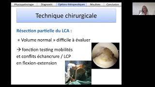 Prise en charge dune Lesion Mucoide du Ligament Croisé Antérieur [upl. by Anividul968]