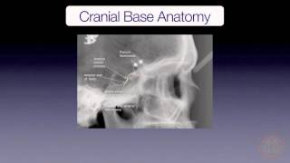 Cranial Base Superimposition [upl. by Llamaj]