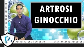 Artrosi del ginocchio [upl. by Shirk909]