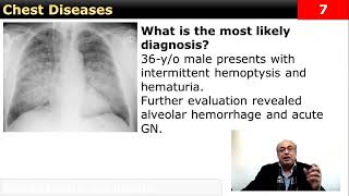 Chest Quick note internalmedicine cme usmle محاضراتباطنة ecg clinical medicine [upl. by Kreiker]