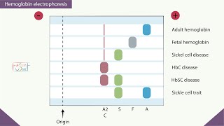 Hemoglobin electrophoresis [upl. by Nnyleuqaj]