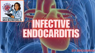 INFECTIVE ENDOCARDITIS [upl. by Josepha]