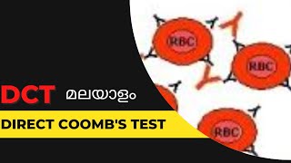 DCTDirect Coombs test മലയാളം [upl. by Kerby459]