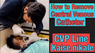 Central Line Removal viral doctor shortvideo cvp viral [upl. by Llirrehs]