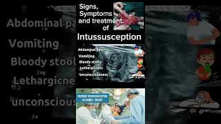 Intussusception A Comprehensive Review of signs symptoms amp Treatment DrSaima khan shorts [upl. by Ronile611]