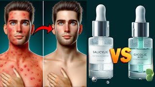 Salicylic Acid vs Glycolic Acid  Which One Is Better For Skin Health  Physiomedics [upl. by Aennaej106]