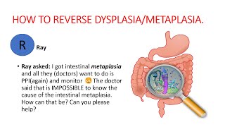 Metaplasia dysplasia How to reverse dysplasia metaplasia Natural treatment [upl. by Rector23]