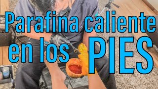 Parafina en los pies para talones agrietados y resecos [upl. by Jammal]