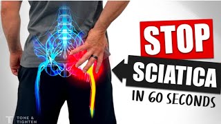 Hip joint stretching exercise sciatica nerve pain relief movement viralvideoyoutube physiocity [upl. by Llenrahc]