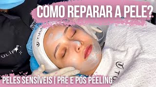 Protocolo de Recuperação Cutânea com Tulípia ft 🦋 Estética Li Amaral [upl. by Keefer]