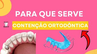 Para que serve contenção ortodôntica   Resumos de Odonto [upl. by Gregoor722]