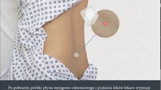 Lumbar Puncture Polish  Nakłucie lędźwiowe [upl. by Nais]