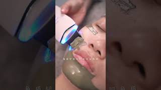 Lets recharge her face today immersiveskincare removeblackheads blackheads velvethair asmr [upl. by Silberman901]