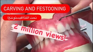 Wax up carving and festooning waxbae dentures [upl. by Daune960]