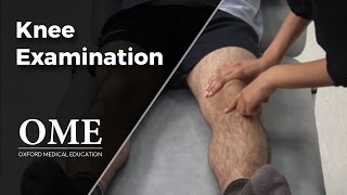 Knee Examination  Orthopaedics [upl. by Nilyarg897]