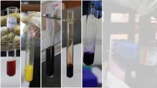 Qualitative Analysis of Amino Acids  Amrita University [upl. by Coraline569]