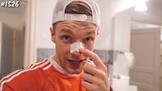 WAT IS ER MET MIJN NEUS  ENZOKNOL VLOG 1526 [upl. by Eldwen618]