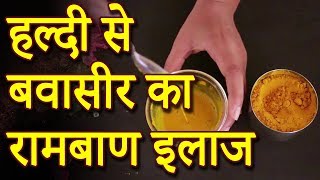 Hemorrhoids Treatment  हल्दी से बवासीर का रामबाण इलाज  Lotus Ayurveda India [upl. by Koralie]