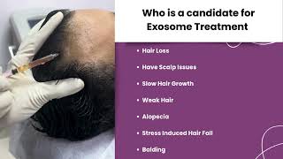 Exosome Treatment l Hair Loss l Balding l Hair Fall l Twacha l Dwarka l Delhi [upl. by Campball]