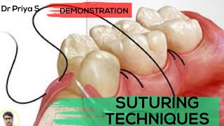 SUTURING TECHNIQUESDEMONSTRATION [upl. by Ahsam668]