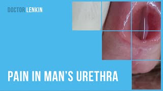 😕 Pain in man’s urethra [upl. by Marino]