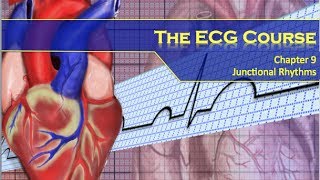 The ECG Course  Junctional Rhythms [upl. by Broderic]