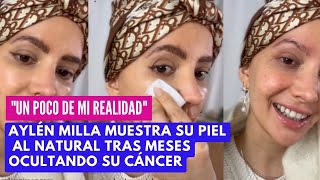 Aylén Milla muestra su piel al natural tras meses ocultando su cáncer “Un poco de mi realidad ” [upl. by Cychosz129]