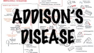 Addisons Disease  Overview clinical features pathophysiology investigations treatment [upl. by Carola]