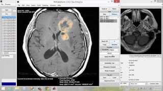 Demo of DICOM Image processing platform [upl. by Fosdick]