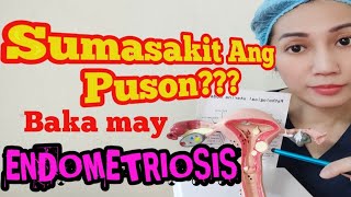 SUMASAKIT BA ANG PUSON lagi Baka May ENDOMETRIOSIS anu nga ba to ShellyPearljacobhugh [upl. by Madai]